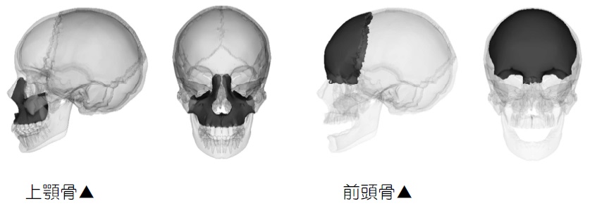 上顎骨と前頭骨、おでこ額と顎関節症と血圧の関係